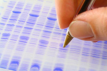 Bild: Protein expression - (Quelle: Max Planck Institute of Molecular Cell Biology and Genetics)